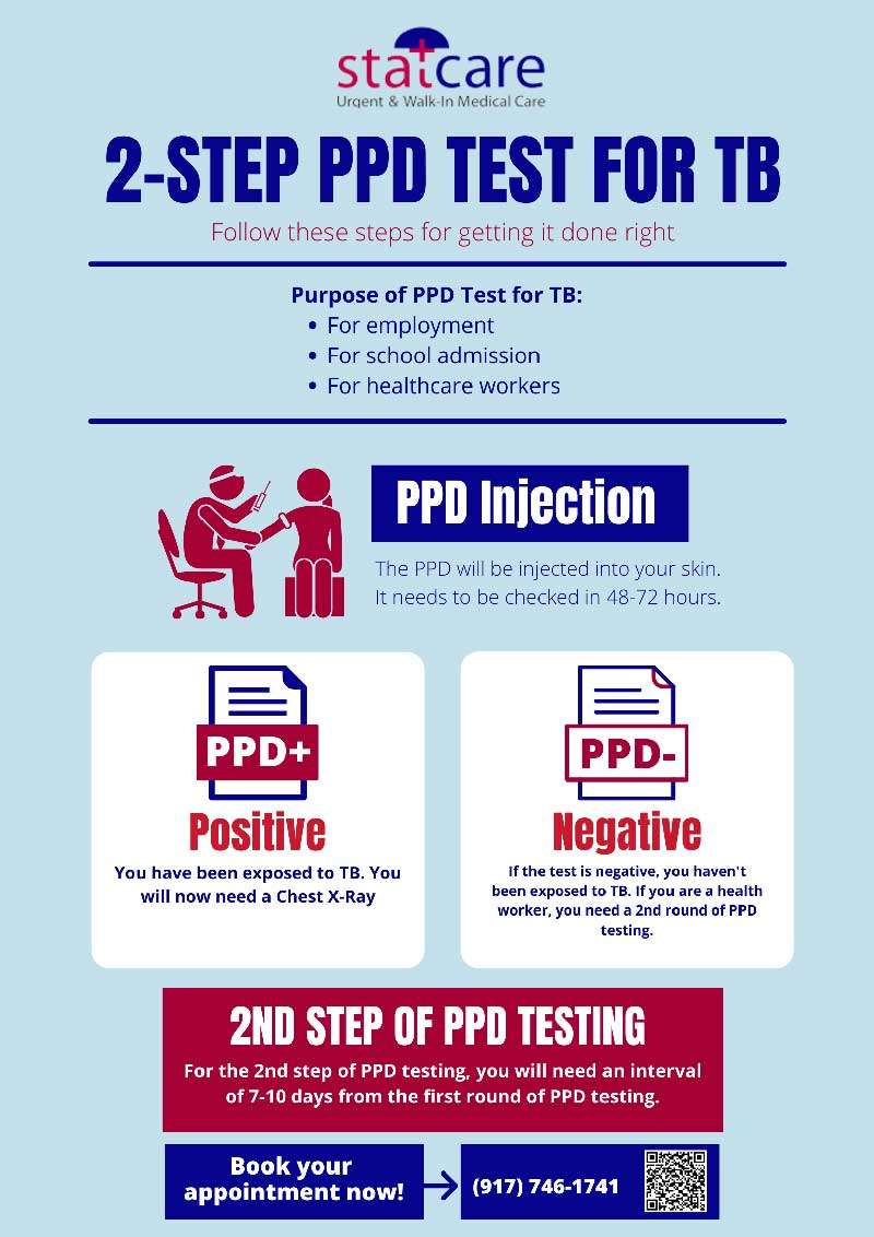  40 PPD Test Near Me 2 Step TB Test Mantoux Test