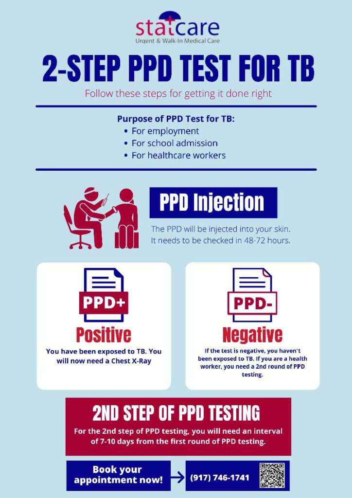  40 PPD Test Near Me 2 Step TB Test Mantoux Test