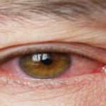 Why you should keep an eye on Pink Eye