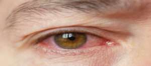 Read more about the article Why you should keep an eye on Pink Eye
