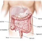 What You Should Know About Colon Cancer Screening