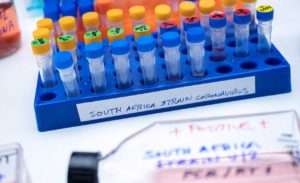 Read more about the article The Tough Fight Against the South Africa COVID Variant